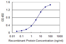 E - SUOX Antibody (monoclonal) (M01) AT4105a