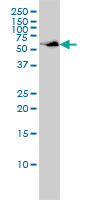 WB - SUOX Antibody (monoclonal) (M01) AT4105a