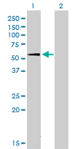 WB - SUOX Antibody (monoclonal) (M01) AT4105a