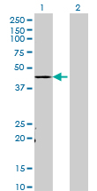 WB - TADA3L Antibody (monoclonal) (M02) AT4135a
