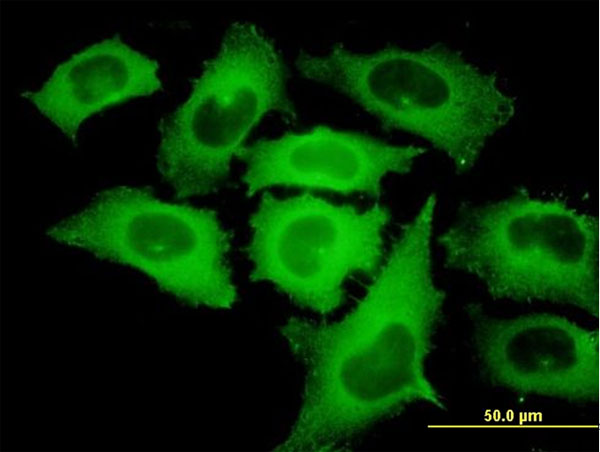 IF - TIPIN Antibody (monoclonal) (M01) AT4247a