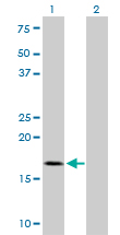WB - TOMM22 Antibody (monoclonal) (M01) AT4302a