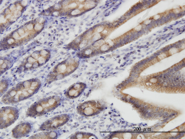IHC - TOMM22 Antibody (monoclonal) (M01) AT4302a