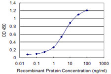 E - TOMM22 Antibody (monoclonal) (M01) AT4302a