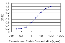 E - TRIP6 Antibody (monoclonal) (M04) AT4364a