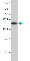 WB - TRIP6 Antibody (monoclonal) (M04) AT4364a