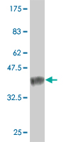 WB - TXNL6 Antibody (monoclonal) (M01) AT4421a