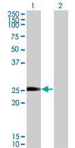 WB - TXNL6 Antibody (monoclonal) (M01) AT4421a