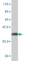 WB - UBE2E2 Antibody (monoclonal) (M01) AT4434a