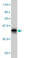 WB - UGT2B10 Antibody (monoclonal) (M01) AT4460a