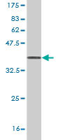 WB - UMPS Antibody (monoclonal) (M05) AT4467a