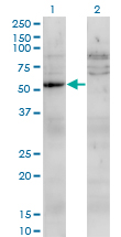WB - UMPS Antibody (monoclonal) (M05) AT4467a