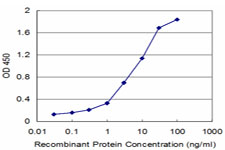 E - UMPS Antibody (monoclonal) (M06) AT4468a