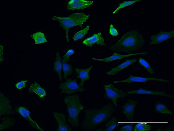 IF - UMPS Antibody (monoclonal) (M06) AT4468a