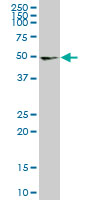 WB - UMPS Antibody (monoclonal) (M06) AT4468a