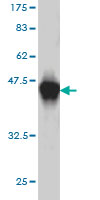 WB - UNC5D Antibody (monoclonal) (M01) AT4472a