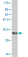 WB - ZDHHC8 Antibody (monoclonal) (M02) AT4571a