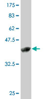 WB - ZMAT4 Antibody (monoclonal) (M01) AT4585a