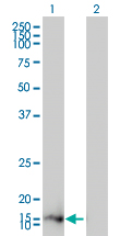 WB - ZMAT4 Antibody (monoclonal) (M01) AT4585a