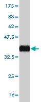 WB - ZNF124 Antibody (monoclonal) (M01) AT4586a