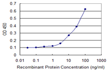 E - ZNF397 Antibody (monoclonal) (M02) AT4636a