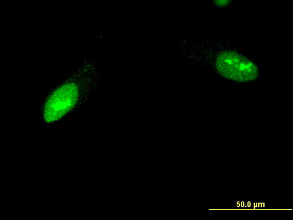 IF - ZNF397 Antibody (monoclonal) (M02) AT4636a