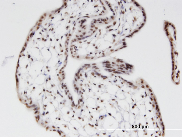 IHC - ZNF397 Antibody (monoclonal) (M02) AT4636a