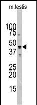 WB - Actin (ACTB/ACTC) Antibody (N-term) AP1491a