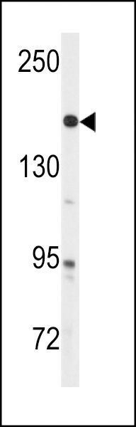 Western blot analysis of anti-ABL1 Antibody (Cat.#AP3018d) in A2058 cell line lysates (35ug/lane). ABL1(arrow) was detected using the purified Pab.