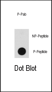 Dot blot analysis of anti-BRAF-pT598 Phospho-specific Pab (Cat.#AP3406a) on nitrocellulose membrane. 50ng of Phospho-peptide or Non Phospho-peptide per dot were adsorbed. Antibody working concentrations are 0.5ug per ml.