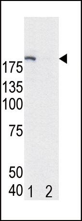 Western blot analysis of EGFR (arrow) in Hela cell lysates, either induced (Lane 1) or noninduced with EGF (Lane 2).