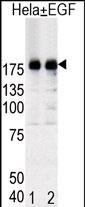 Western blot analysis of EGFR (arrow) in Hela cell lysates, either induced (Lane 1) or noninduced with EGF (Lane 2).