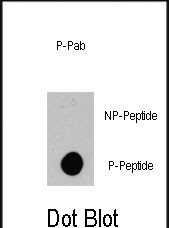 Dot blot analysis of anti-BRAF-pS445 Phospho-specific Pab (Cat.#AP3418a) on nitrocellulose membrane. 50ng of Phospho-peptide or Non Phospho-peptide per dot were adsorbed. Antibody working concentrations are 0.5ug per ml.