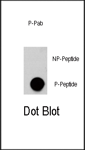 Dot blot analysis of anti-AKT3-pS472 Phospho-specific Pab (RB13331) on nitrocellulose membrane. 50ng of Phospho-peptide or Non Phospho-peptide per dot were adsorbed. Antibody working concentrations are 0.5ug per ml.