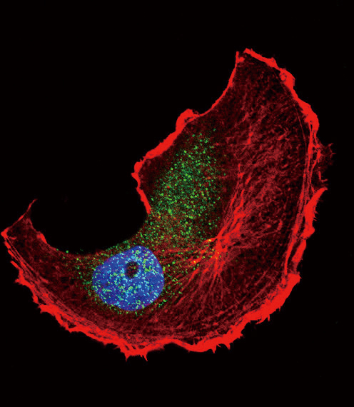 Confocal immunofluorescent analysis of Phospho-TSC2-S1798 Antibody(Cat#AP3478a) with MCF-7 cell followed by Alexa Fluor 488-conjugated goat anti-rabbit lgG (green).Actin filaments have been labeled with Alexa Fluor 555 phalloidin (red).DAPI was used to stain the cell nuclear (blue).