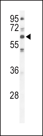 WB - PKC iota Antibody (N-term) AP7022a
