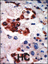 IHC-P - PKC iota Antibody (N-term) AP7022a