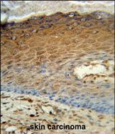 IHC-P - AK7 Antibody (C-term) AP7076d