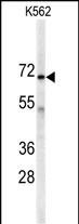 WB - AK7 Antibody (C-term) AP7076d