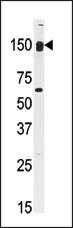 Western blot analysis of anti-CLASP2 Antibody (C-term) (Cat. #AP7181b) in mouse kidney tissue lysates (35ug/lane). CLASP2(arrow) was detected using the purified Pab.