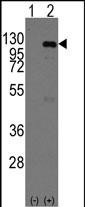 Western blot analysis of CASC3 (arrow) using rabbit polyclonal CASC3  Antibody (Cat.#AP7264b).293 cell lysates (2 ug/lane) either nontransfected (Lane 1) or transiently transfected with the CASC3  gene (Lane 2) (Origene Technologies).