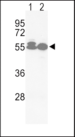 Western blot analysis of hACVRL1-L489 (Cat.#AP7807b) in Jurkat(lane 1), HepG2(lane 2) cell line lysates (35ug/lane). ACVRL1 (arrow) was detected using the purified Pab.