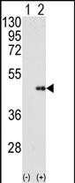 Western blot analysis of FNTB (arrow) using FNTB Antibody (N-term) (Cat.#AP2414a). 293 cell lysates (2 ug/lane) either nontransfected (Lane 1) or transiently transfected with the FNTB gene (Lane 2) (Origene Technologies).