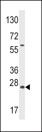 Western blot analysis of anti-GADD45A Antibody (N-term) (Cat.#AP2785a) in Y79 cell line lysates (35ug/lane). GADD45A (arrow) was detected using the purified Pab.
