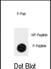 Dot blot analysis of anti-Phospho-ACK1-pY518 Antibody (Cat.#AP3587a) on nitrocellulose membrane. 50ng of Phospho-peptide or Non Phospho-peptide per dot were adsorbed. Antibody working concentrations are 0.5ug per ml.