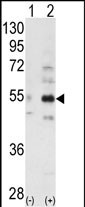 Western blot analysis of ALS2CR2 (arrow) using ALS2CR2 Antibody (C-term L289) (Cat.#AP7110d). 293 cell lysates (2 ug/lane) either nontransfected (Lane 1) or transiently transfected with the ALS2CR2 gene (Lane 2) (Origene Technologies).