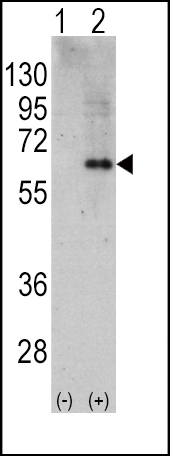 Western blot analysis of PRKAA2 (arrow) using rabbit polyclonal PRKAA2 Antibody (C-term) (RB11657). 293 cell lysates (2 ug/lane) either nontransfected (Lane 1) or transiently transfected with the PRKAA2 gene (Lane 2) (Origene Technologies).