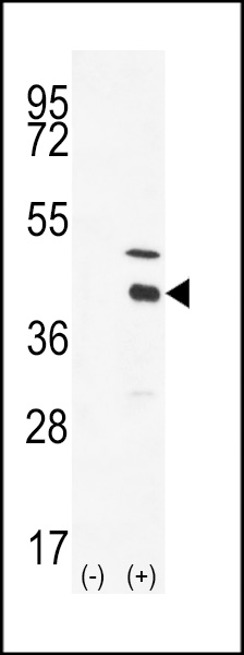 Western blot analysis of DOK4 (C-term) (arrow) using DOK4 Antibody (C-term) (Cat.#AP7692b). 293 cell lysates (2 ug/lane) either nontransfected (Lane 1) or transiently transfected with the DOK4 gene (Lane 2) (Origene Technologies).