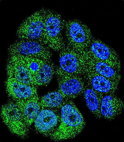 Confocal immunofluorescent analysis of ABL1 Antibody (Center)(Cat#AP7694d) with MCF-7 cell followed by Alexa Fluor 488-conjugated goat anti-rabbit lgG (green). DAPI was used to stain the cell nuclear (blue).