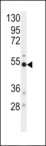 Western blot analysis of anti-BACE Antibody (S498) (Cat.#AP7774a) in mouse cerebellum tissue lysates (35ug/lane). BACE (arrow) was detected using the purified Pab.
